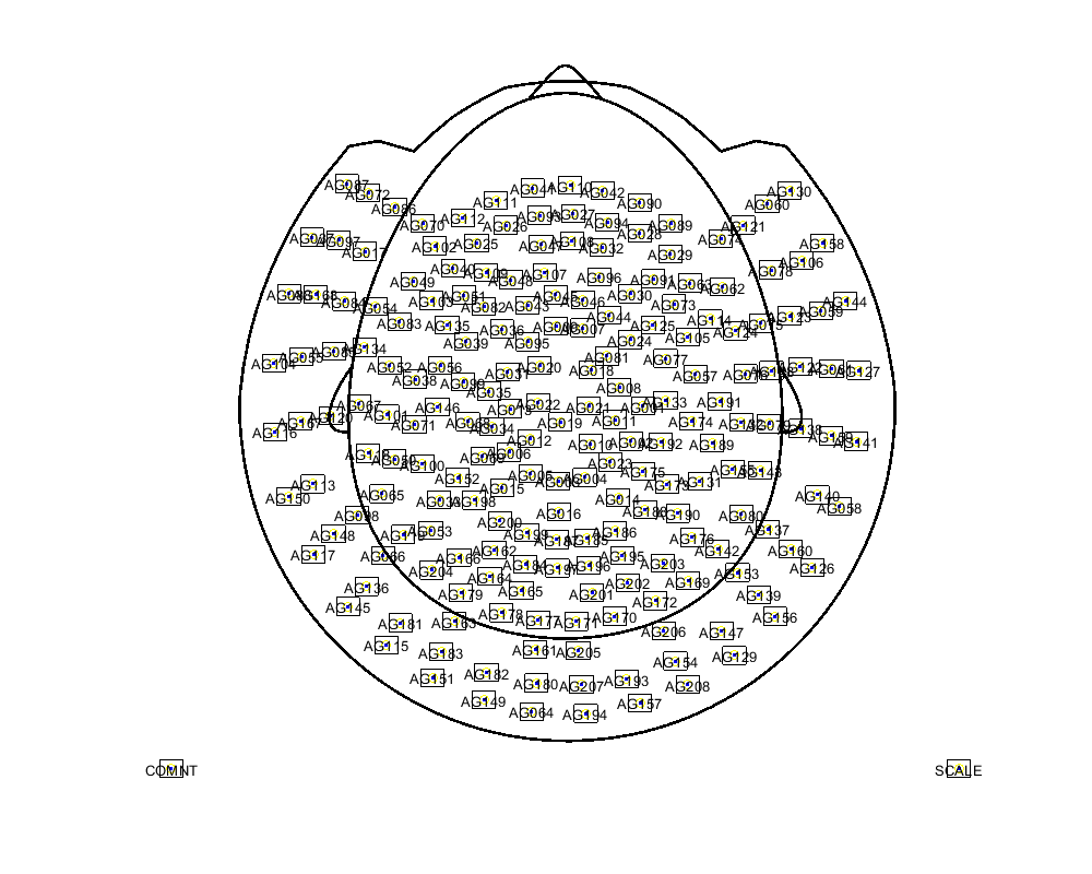 ../../../_images/6-meg-pipeline-gallery_notebooks_fieldtrip_fieldtrip_kit_audio_visual_motor_10_1.png